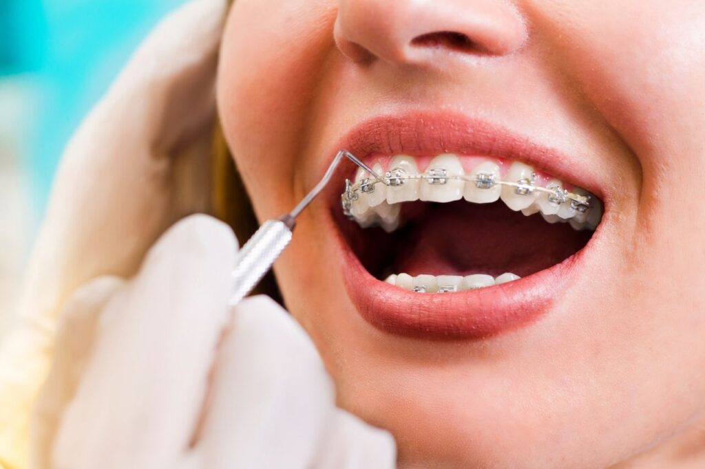 best orthodontist software